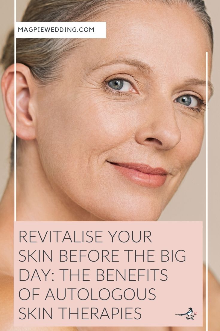 Revitalise Your Skin Before The Big Day: The Benefits of Autologous Skin Therapies